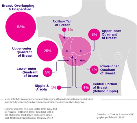 breast wikipedia